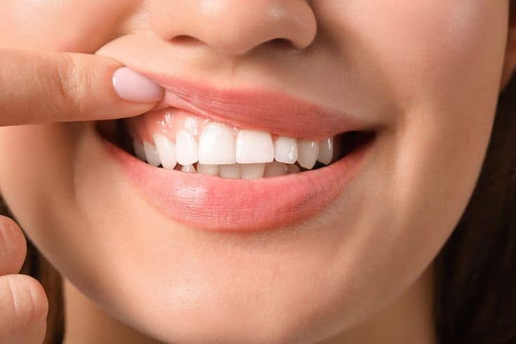 A close-up of a woman smiling, pointing to her white, healthy teeth, emphasizing dental health and cosmetic dentistry services.